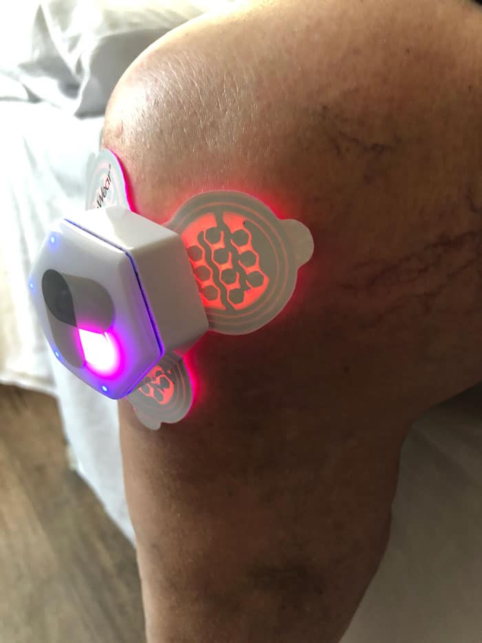 laser therapy on knee pain